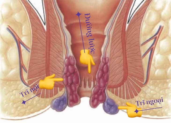 Thực phẩm chức năng hỗ trợ điều trị bệnh trĩ tốt nhất Hà Nội | LH 0839532222